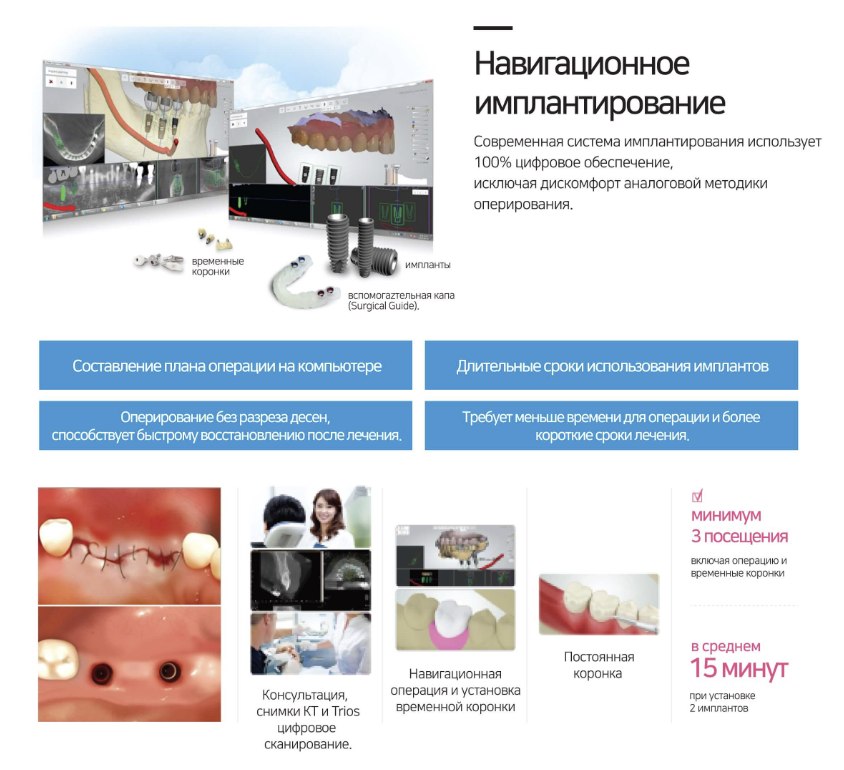 Medmost | Лечение в Стоматологическом госпитале Apple Tree, Коян, Южная Корея (Appletree Dental Hospital) Лечение в Стоматологическом госпитале Apple Tree, Коян, Южная Корея (Appletree Dental Hospital)