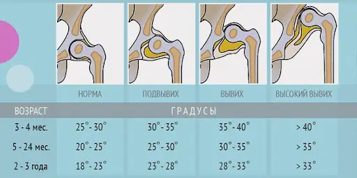 Medmost | Методы реабилитации ДЦП с доказанной эффективностью Методы реабилитации ДЦП с доказанной эффективностью