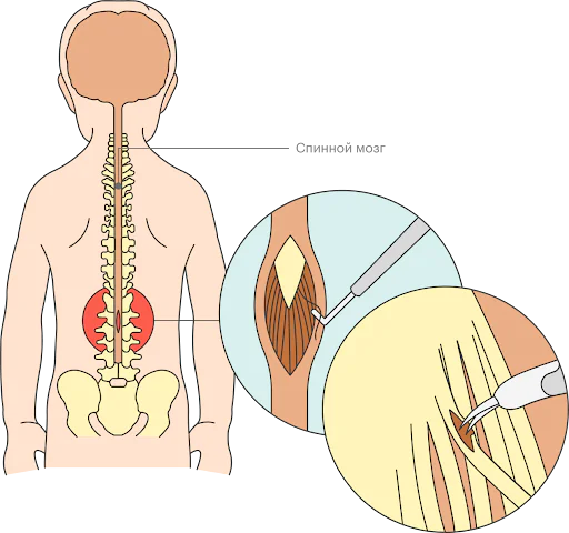 Medmost | Методы реабилитации ДЦП с доказанной эффективностью Методы реабилитации ДЦП с доказанной эффективностью