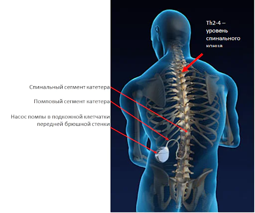 Medmost | Методы реабилитации ДЦП с доказанной эффективностью Методы реабилитации ДЦП с доказанной эффективностью