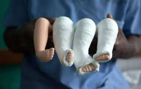 Medmost | Методы реабилитации ДЦП с доказанной эффективностью Методы реабилитации ДЦП с доказанной эффективностью