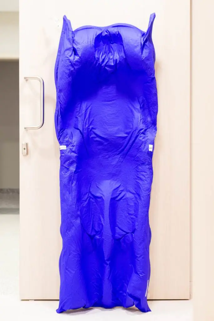 Medmost | Лечение киберножом за границей: радиохирургия в онкологии и нейрохирургии, насколько это безопасно, как проходит лечение Лечение киберножом за границей: радиохирургия в онкологии и нейрохирургии, насколько это безопасно, как проходит лечение