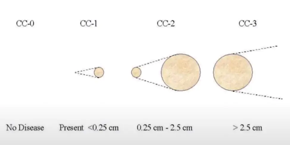 Medmost | Лечение канцероматоза в Корее методом HIPEC и LHIPEC Оценка полноты циторедукции