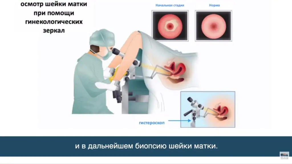 Medmost | Лечение рака шейки матки в Корее. Интервью корейского врача Лечение рака шейки матки в Корее. Интервью корейского врача