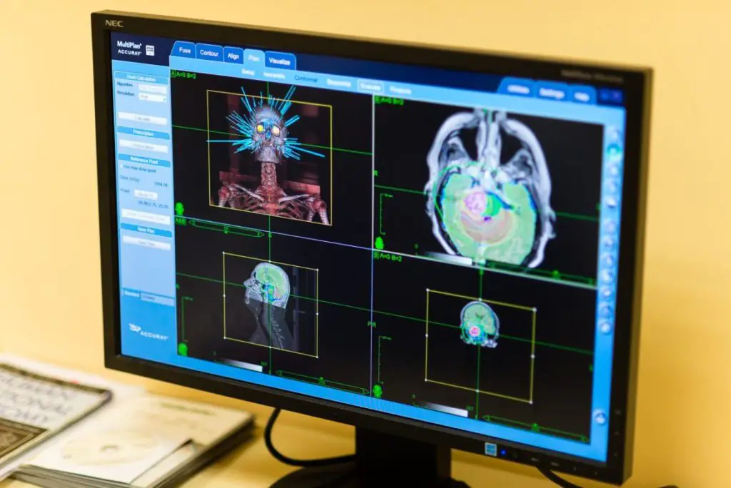 Medmost | Лечение киберножом за границей: радиохирургия в онкологии и нейрохирургии, насколько это безопасно, как проходит лечение Лечение киберножом за границей: радиохирургия в онкологии и нейрохирургии, насколько это безопасно, как проходит лечение
